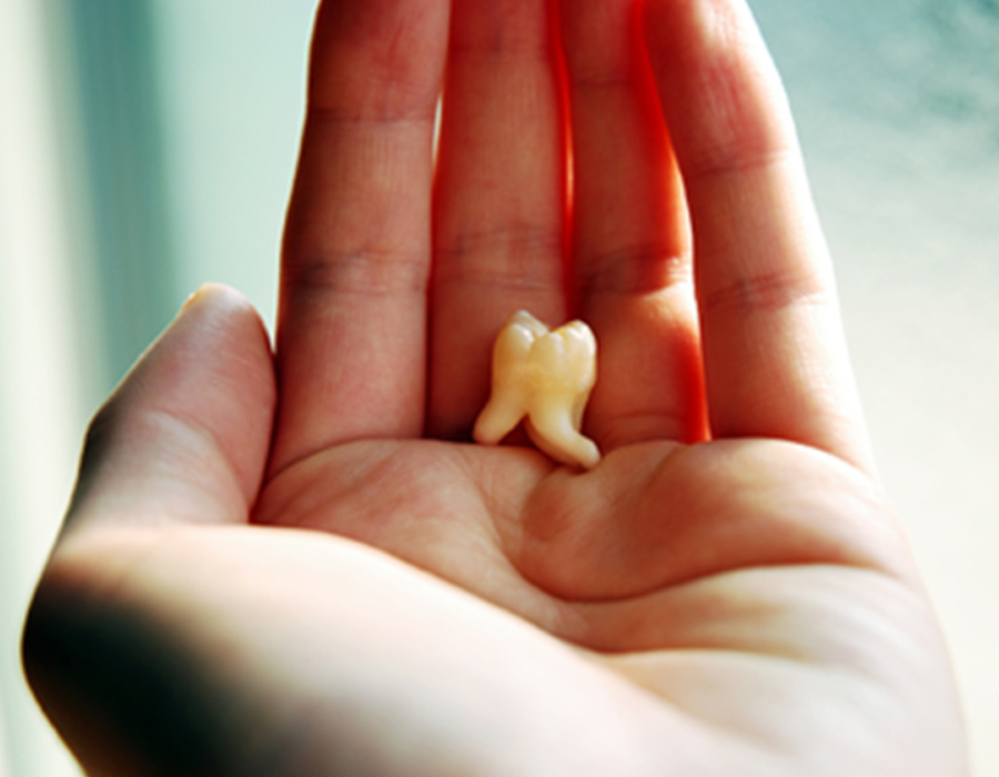 福岡県親知らずとは