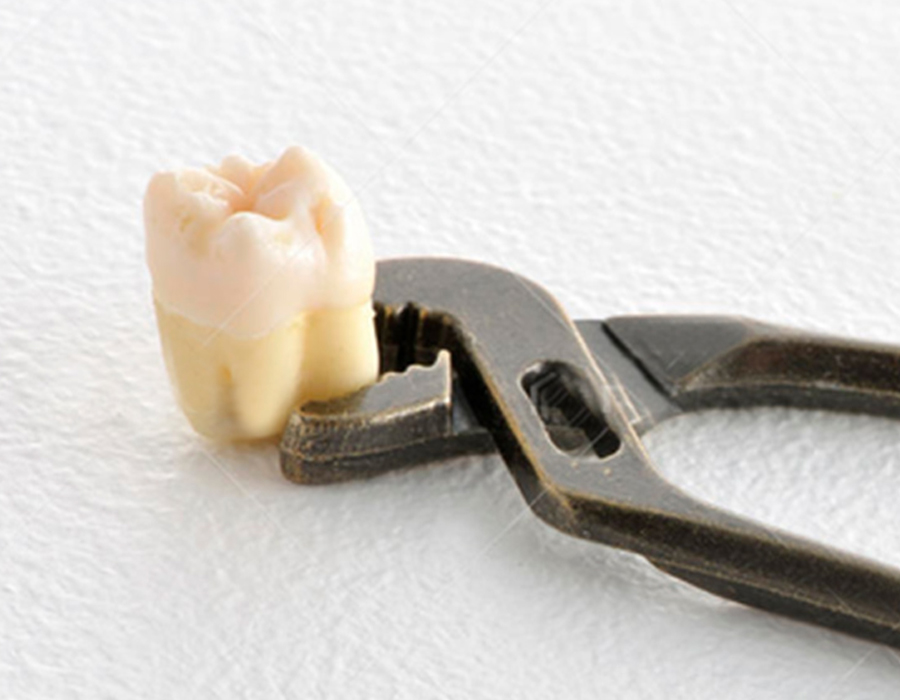 親知らず専門外来エキスパート